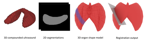 Illustration describing Partial 3D Thyroid Registration using GCN project