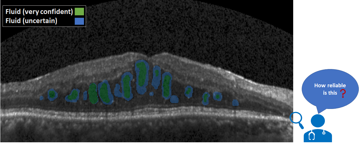 An illustration of the project Uncertainty Estimation for Deep Medical Image Segmentation